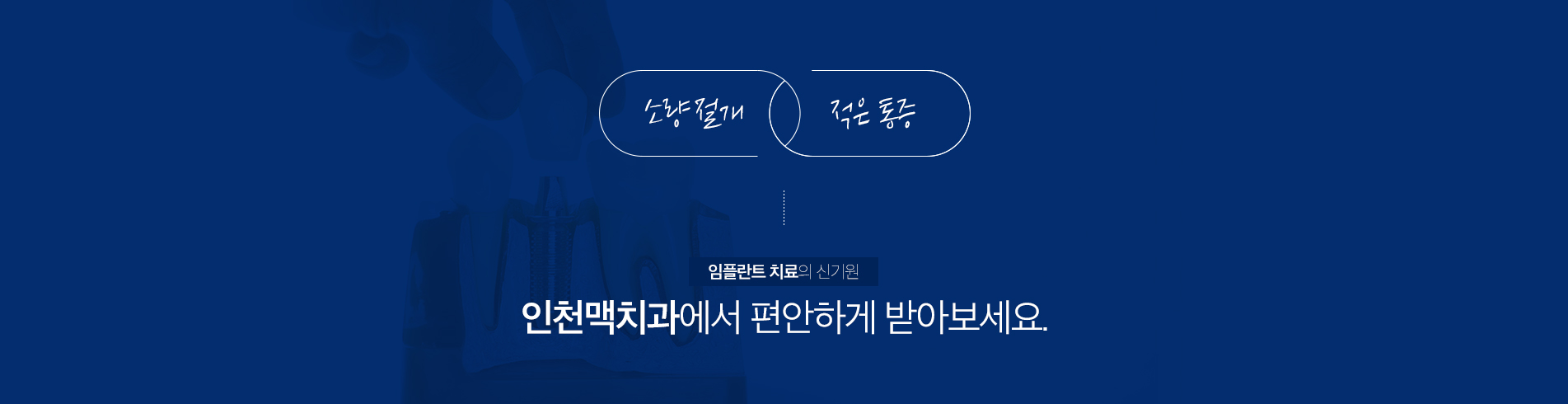 전체 임플란트 (All-on-4 · All-on-6)